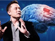 Neuralink không được cấp phép thử nghiệm cấy chip lên não người